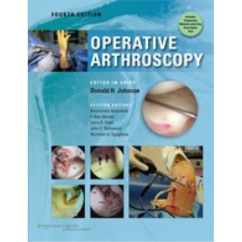 Operative Arthroscopy 4th edition